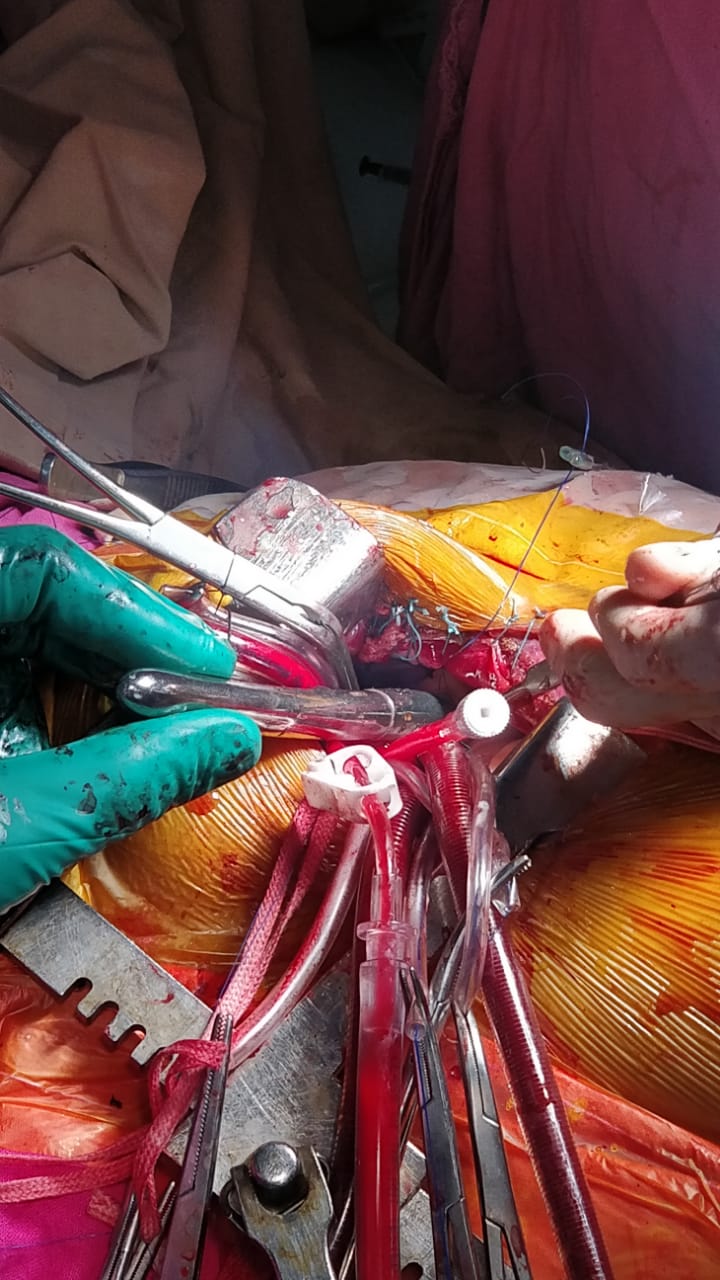 Unique Surgical Procedures surgical photo