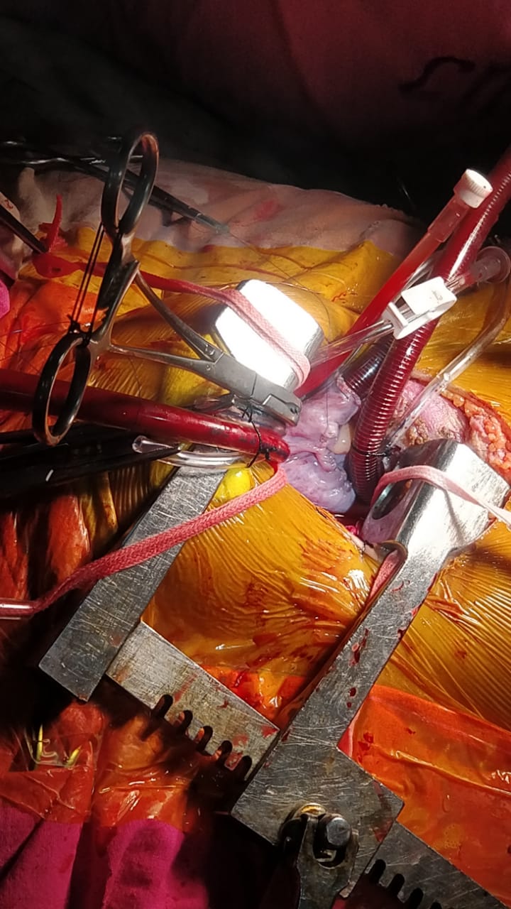 Unique Surgical Procedures surgical photo