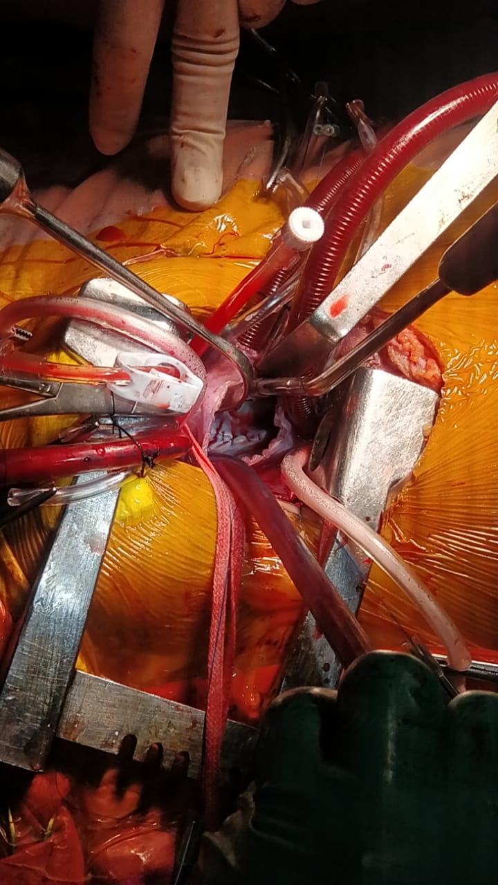 Unique Surgical Procedures surgical photo