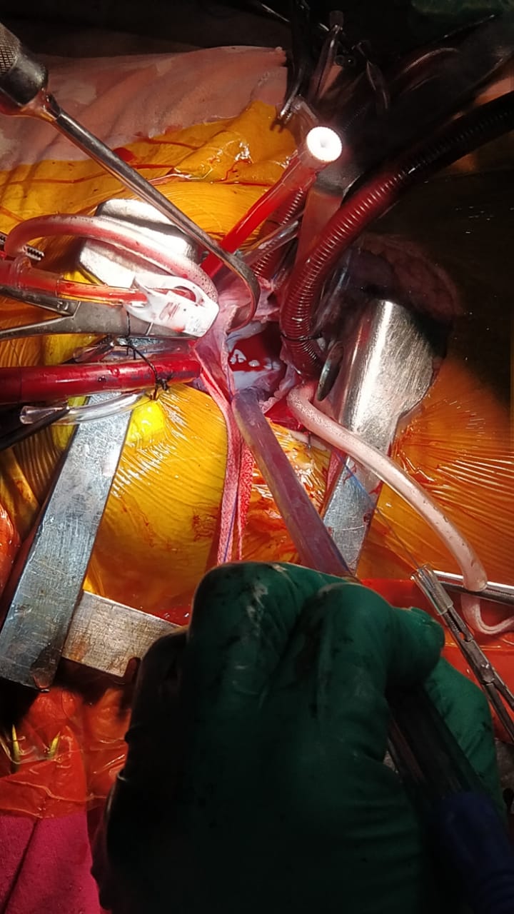 Unique Surgical Procedures surgical photo