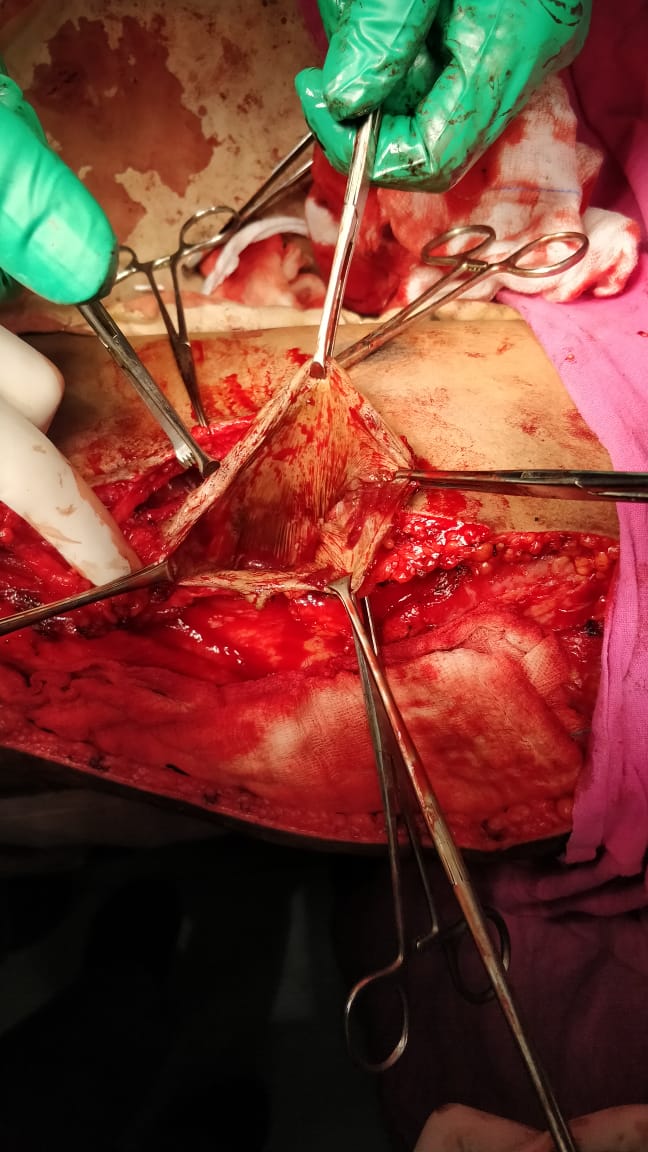 Unique Surgical Procedures surgical photo