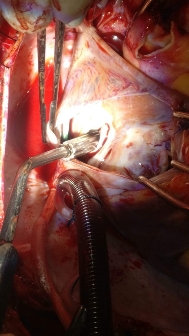 Unique Surgical Procedures surgical photo