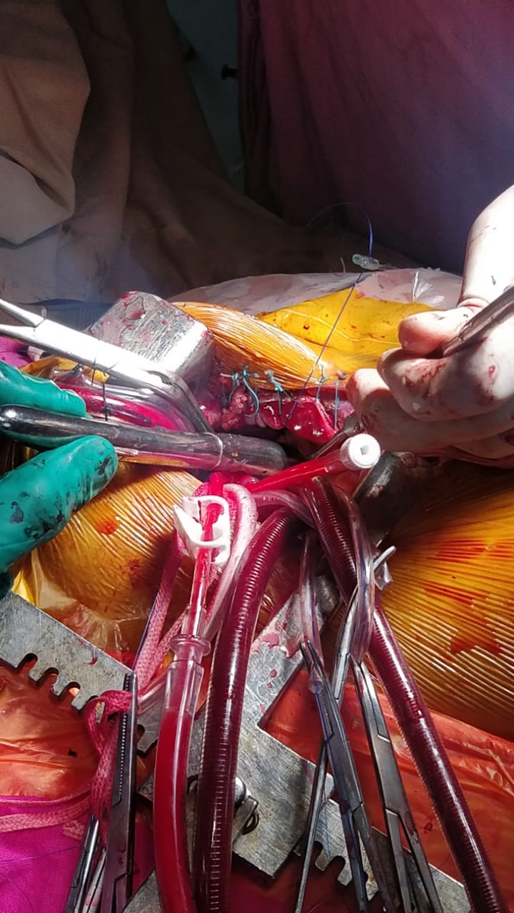 Unique Surgical Procedures surgical photo