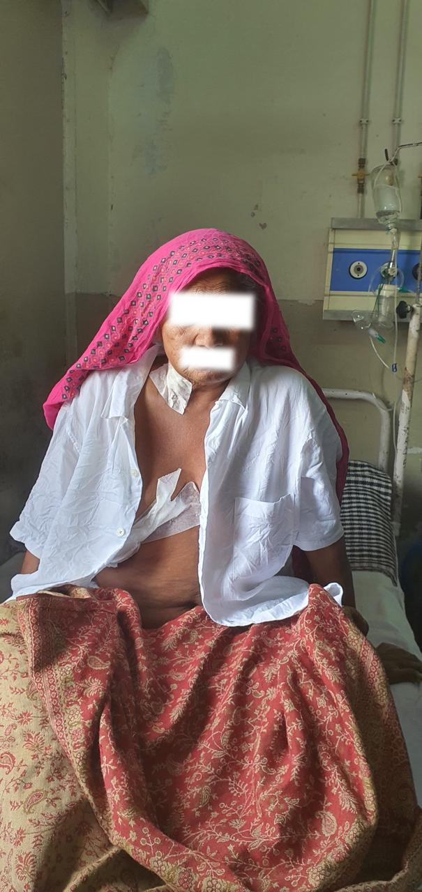 VSD - Ventricular Septal Defect surgical photo