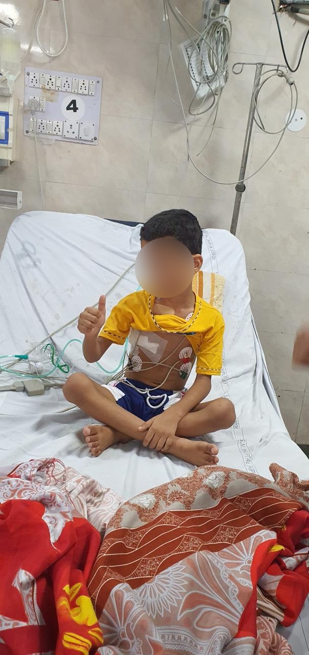 VSD - Ventricular Septal Defect surgical photo