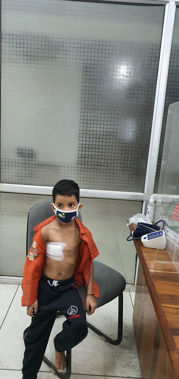 VSD - Ventricular Septal Defect surgical photo