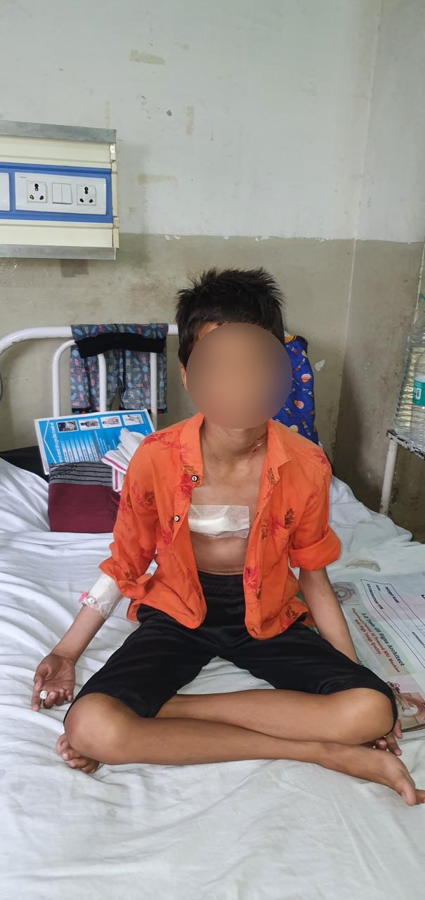 VSD - Ventricular Septal Defect surgical photo