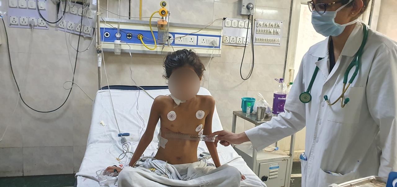 VSD - Ventricular Septal Defect surgical photo