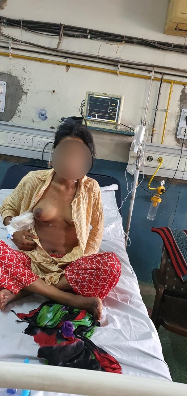 VSD - Ventricular Septal Defect surgical photo