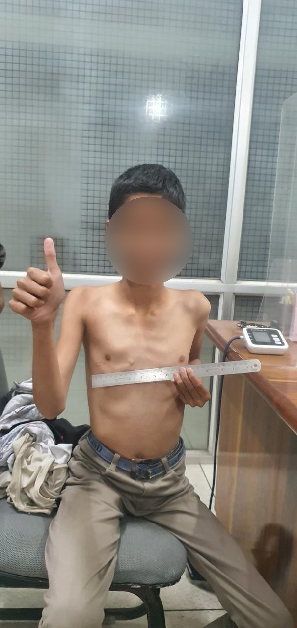 VSD - Ventricular Septal Defect surgical photo