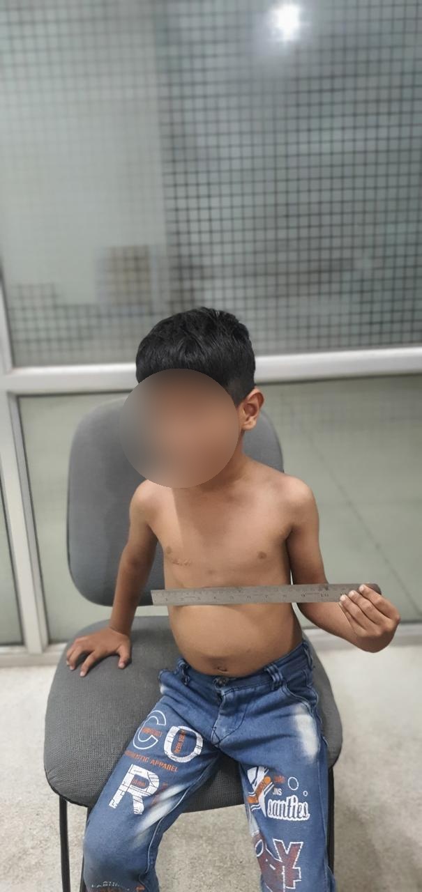 VSD - Ventricular Septal Defect surgical photo