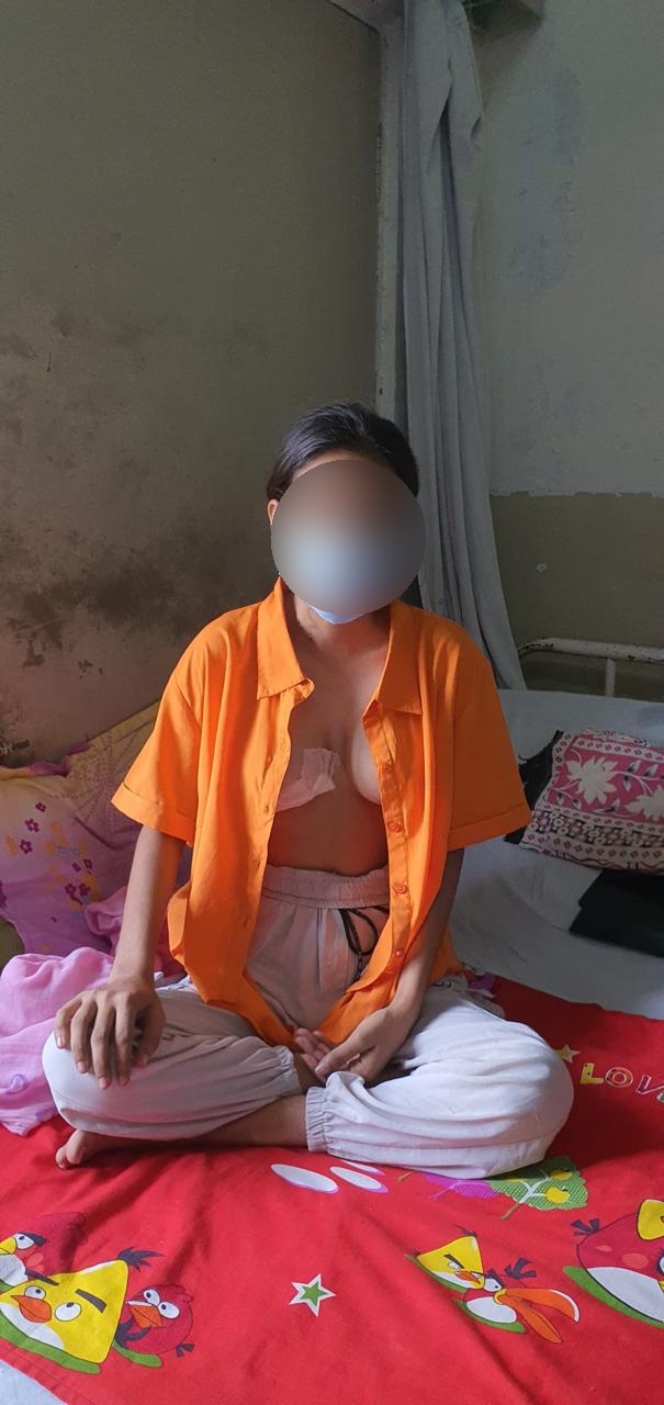 VSD - Ventricular Septal Defect surgical photo